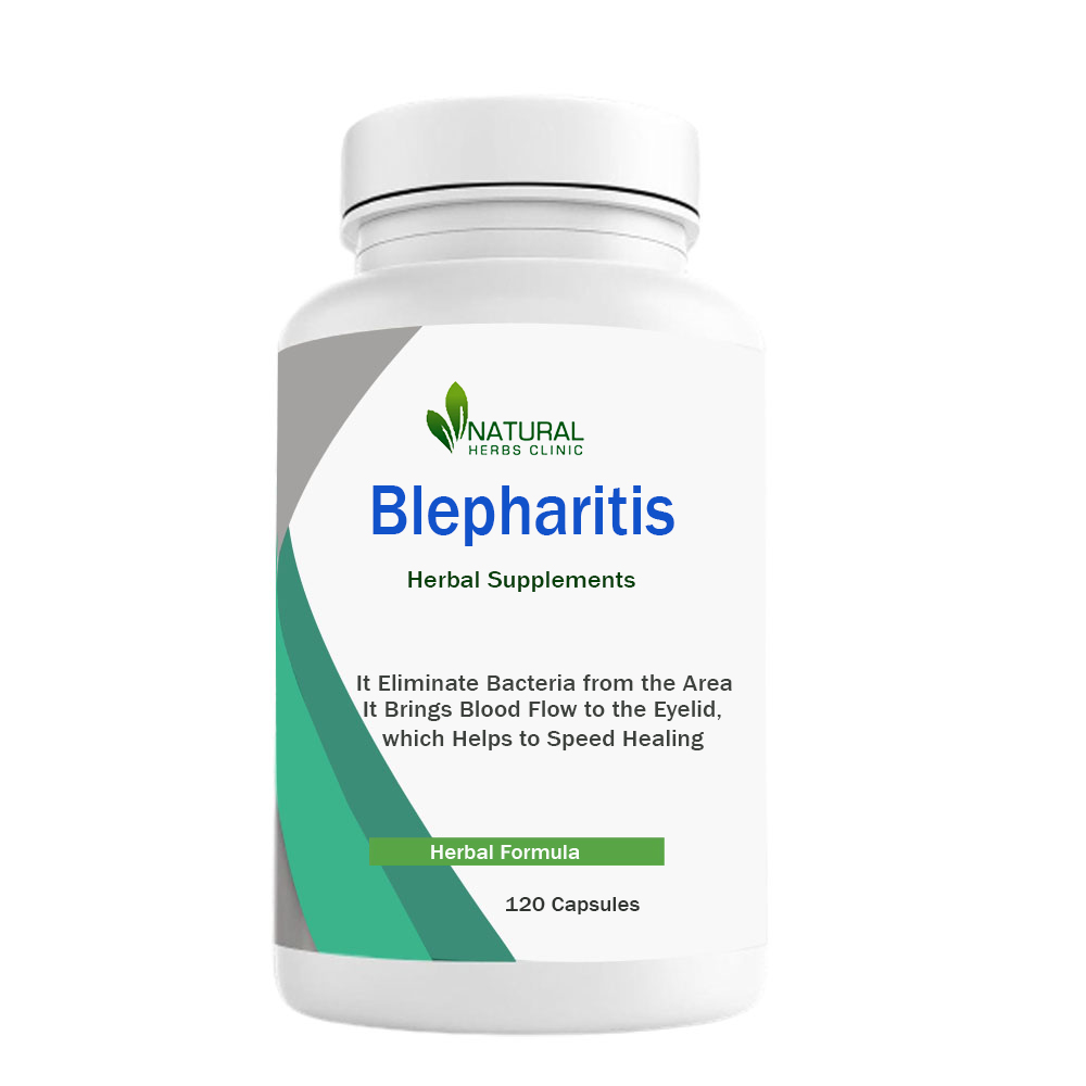 Herbal Treatment for Blepharitis | Natural Herbs Clinic
