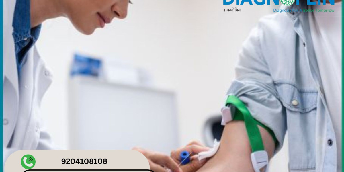 HbA1C Test in Pune: Accurate & Reliable Diabetes Testing