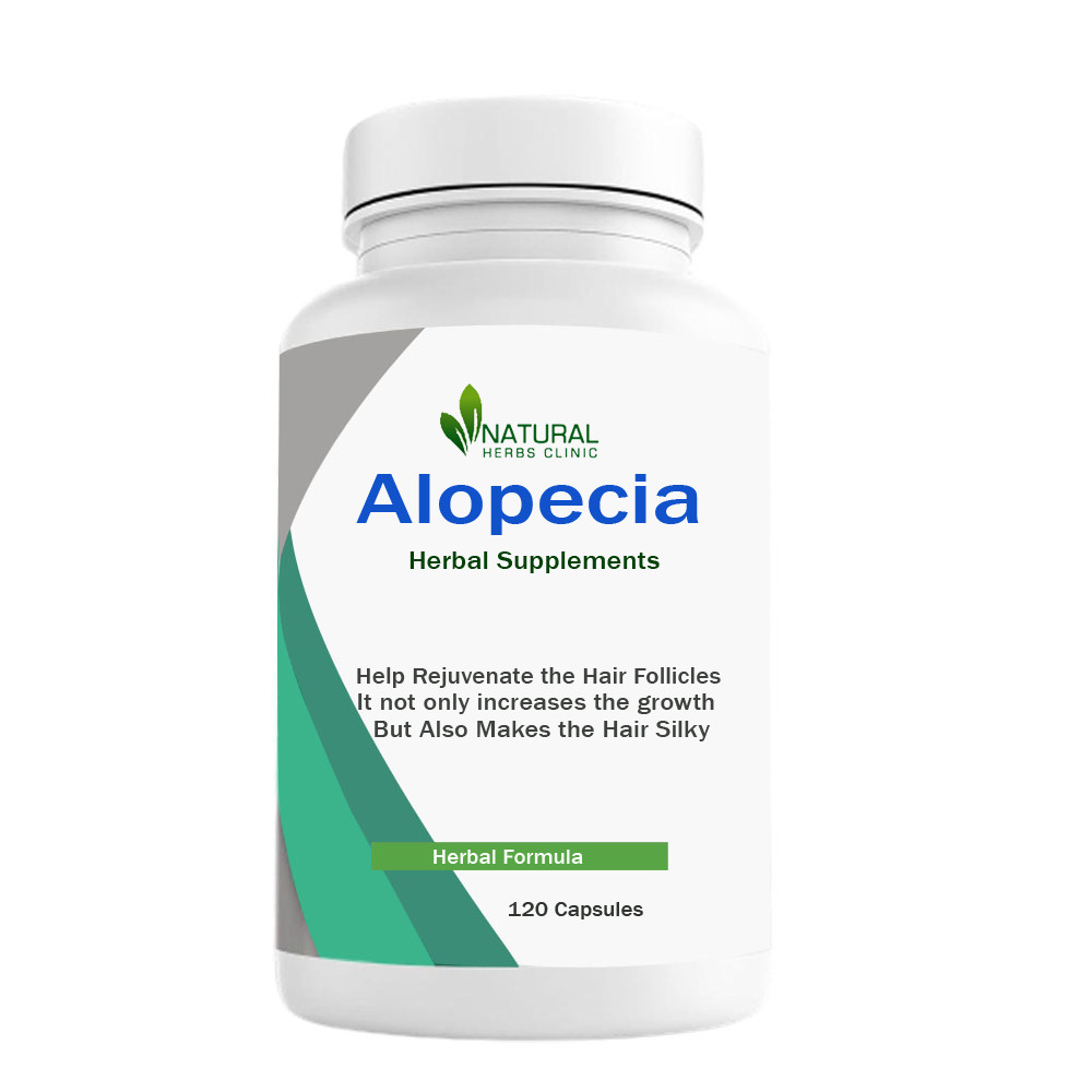 Herbal Treatment for Alopecia | Natural Herbs Clinic