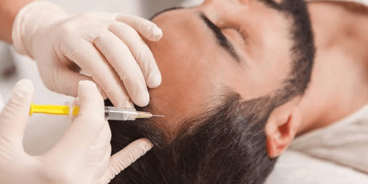 A Complete Guide to GFC Hair Treatment in Bangalore